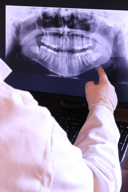 Best Emergency Dental Care for Sports Injuries in Clio, MI