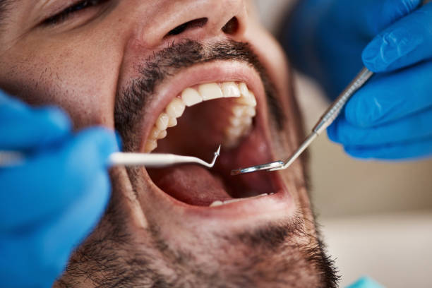 Reliable MI Emergency Dental Service Solutions